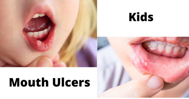 2 Year Old Keeps Getting Mouth Ulcers